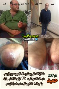 درمان پسوریازیس با خام گیاهخواری