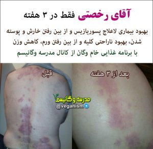 درمان دفع پروتیین کلیه با خام گیاهخواری