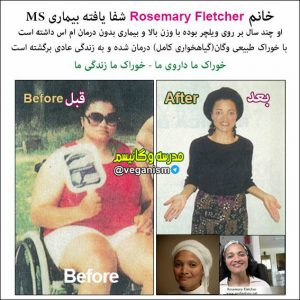 درمان ام اس با خام گیاهخواری